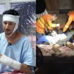 Peão detalha como se salvou de ataque brutal de onça em MS